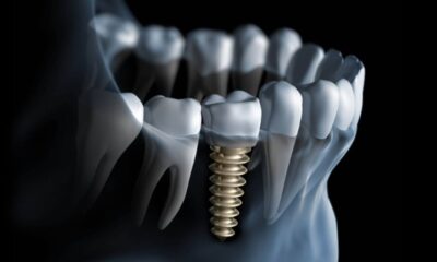 Oral