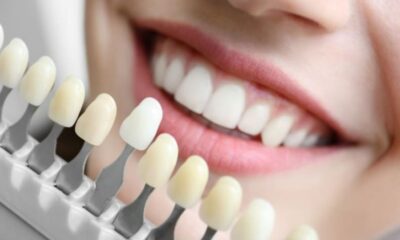 Cosmetic Teeth Shaping