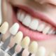 Cosmetic Teeth Shaping