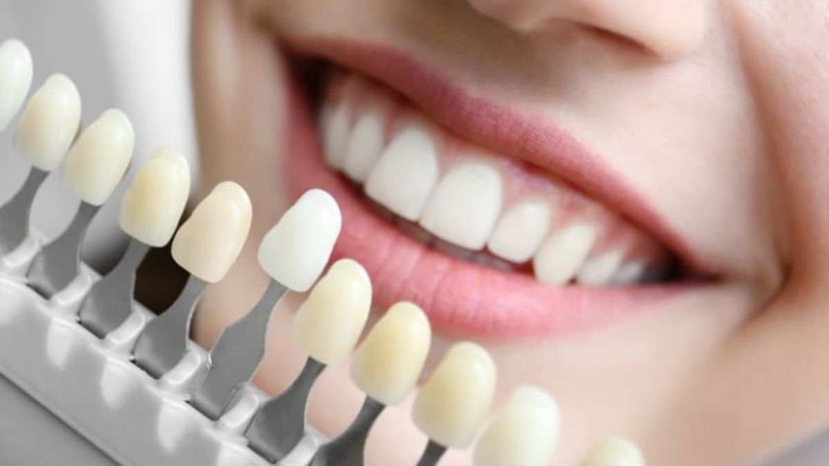 Cosmetic Teeth Shaping