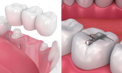 Dental
