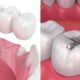 Dental
