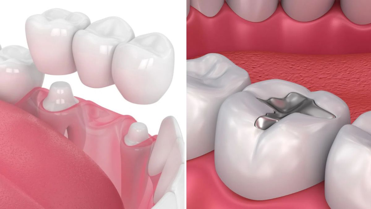 Dental