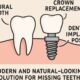 Dental Implant