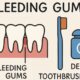 Bleeding Gums