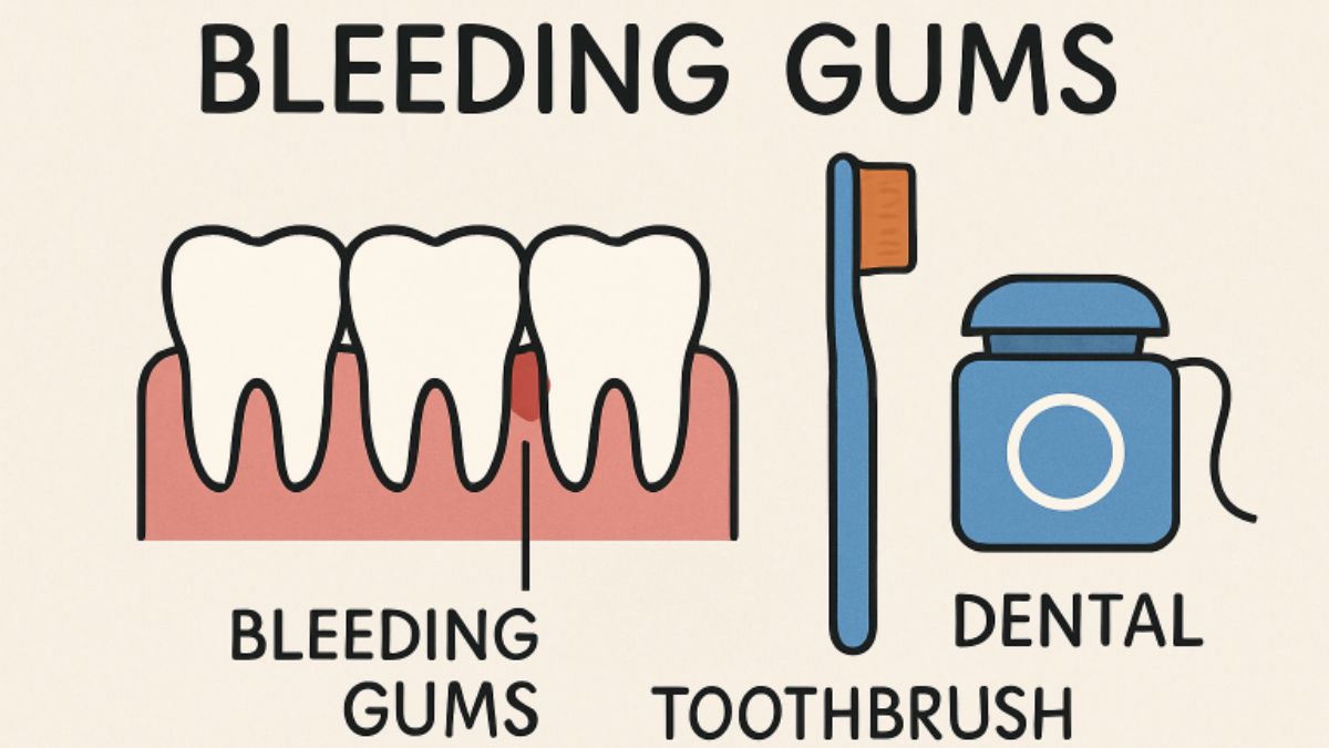 Bleeding Gums