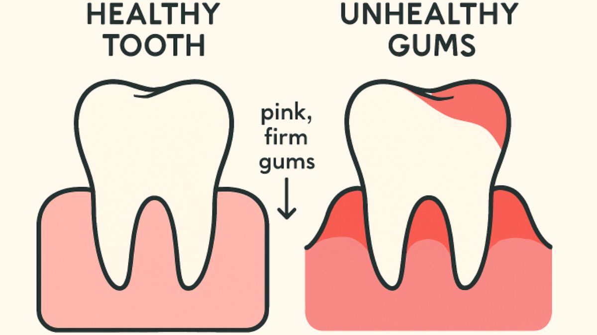 Gum Health